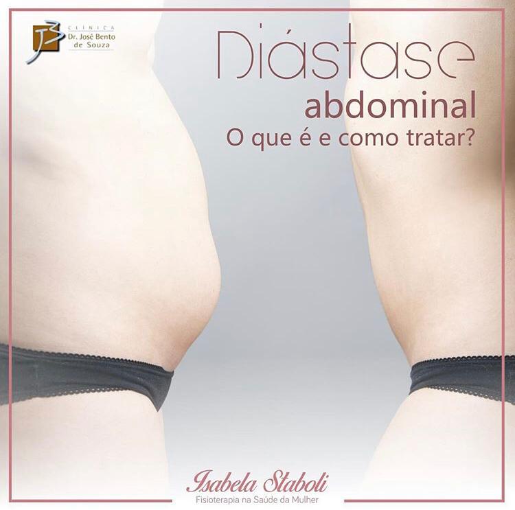 Diástase abdominal: saiba o que é e como tratar